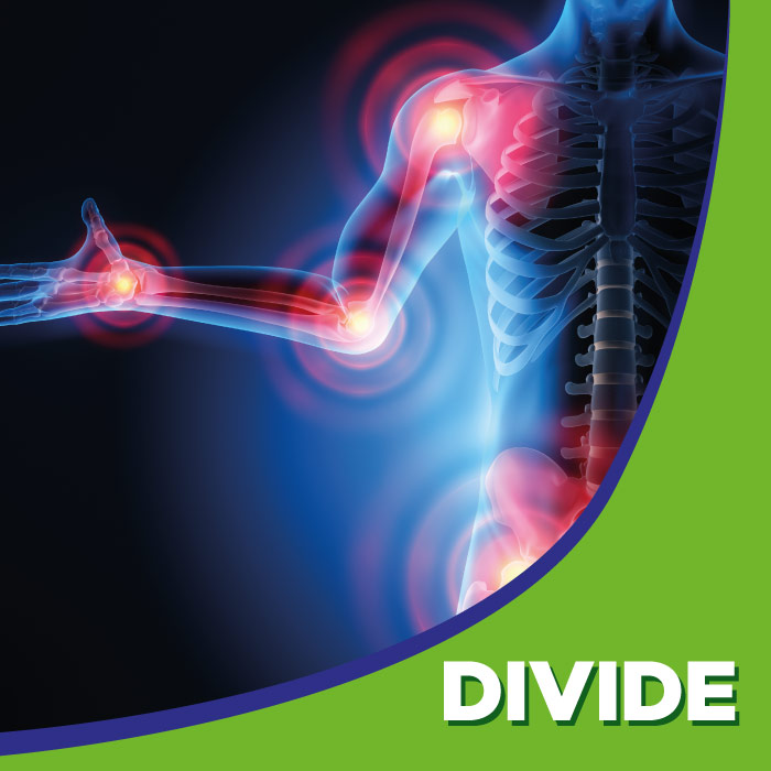 Divide