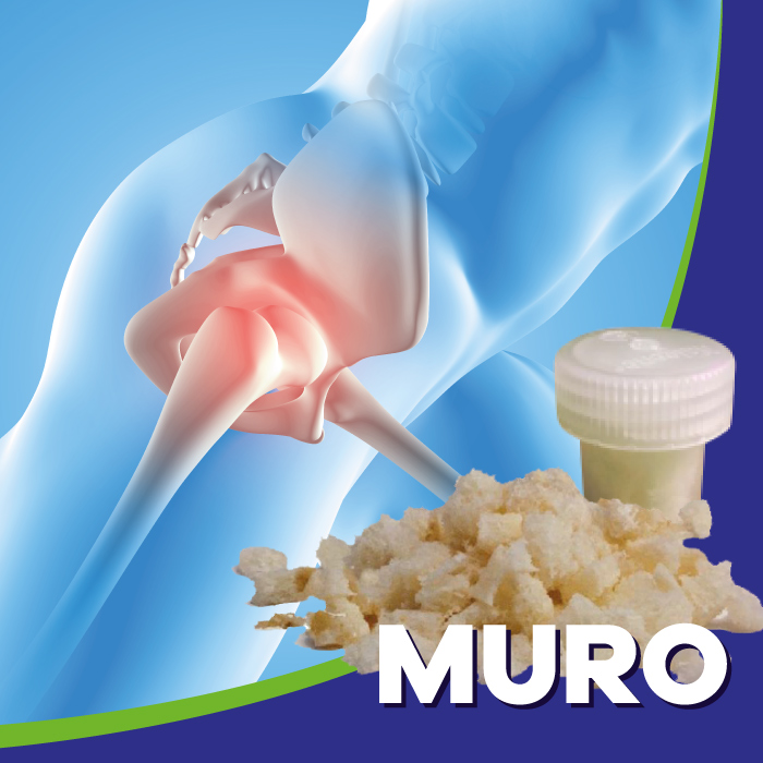 Muro