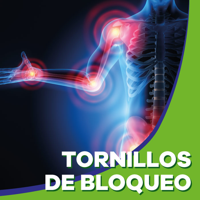 Tornillos de bloqueo